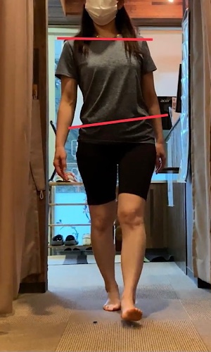 足指の変化 before