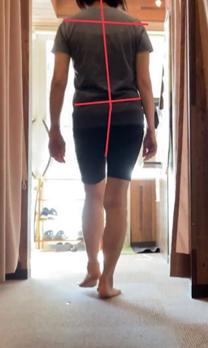 足指の変化 after