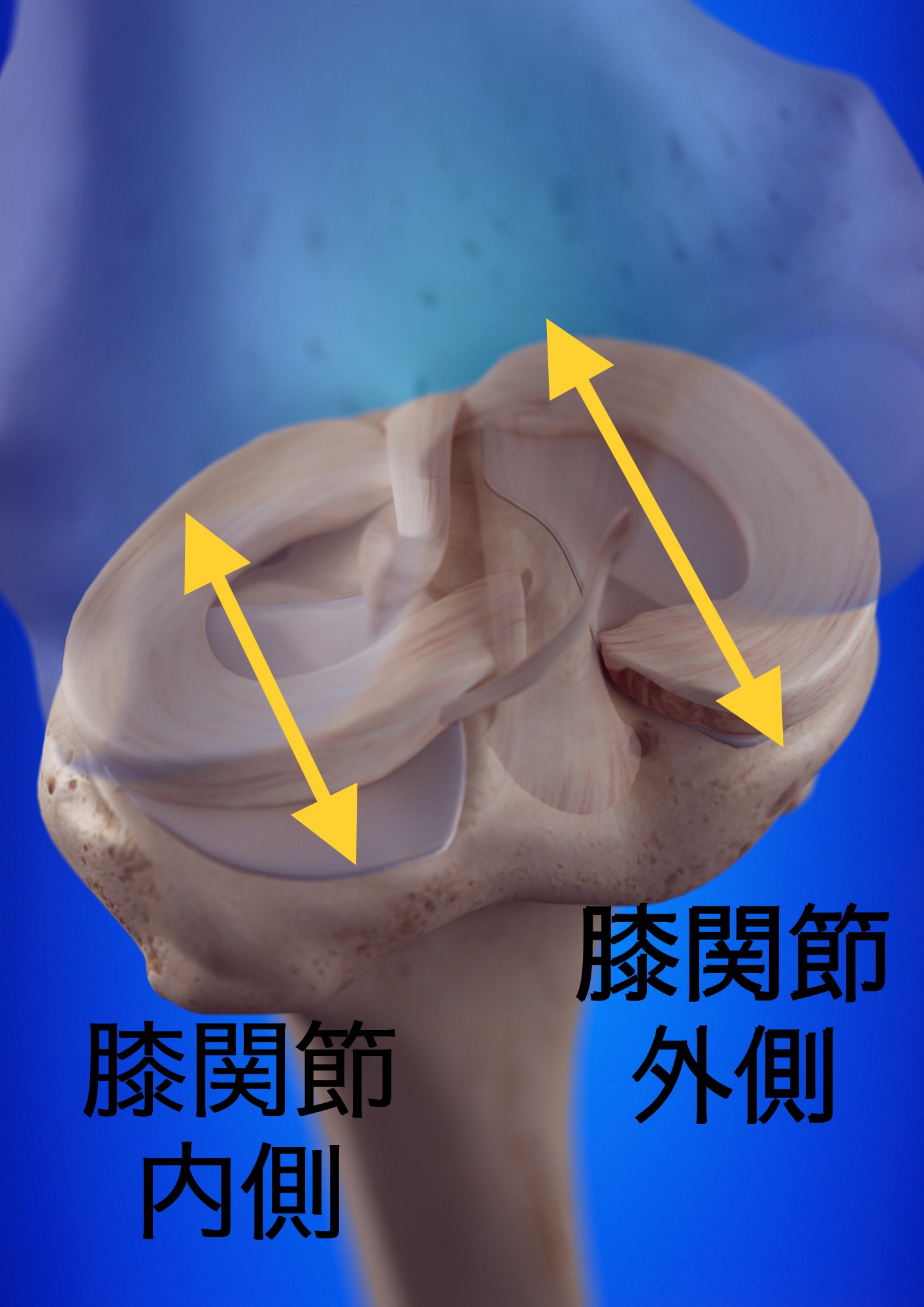 半月板損傷はスポーツ選手だけの怪我じゃない？仙台で膝の痛みでお悩みの方はへ