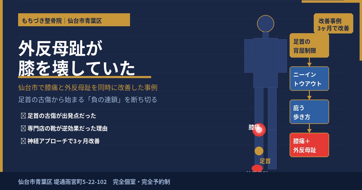 外反母趾が膝を壊していた｜仙台市で膝痛と外反母趾を同時に改善した事例