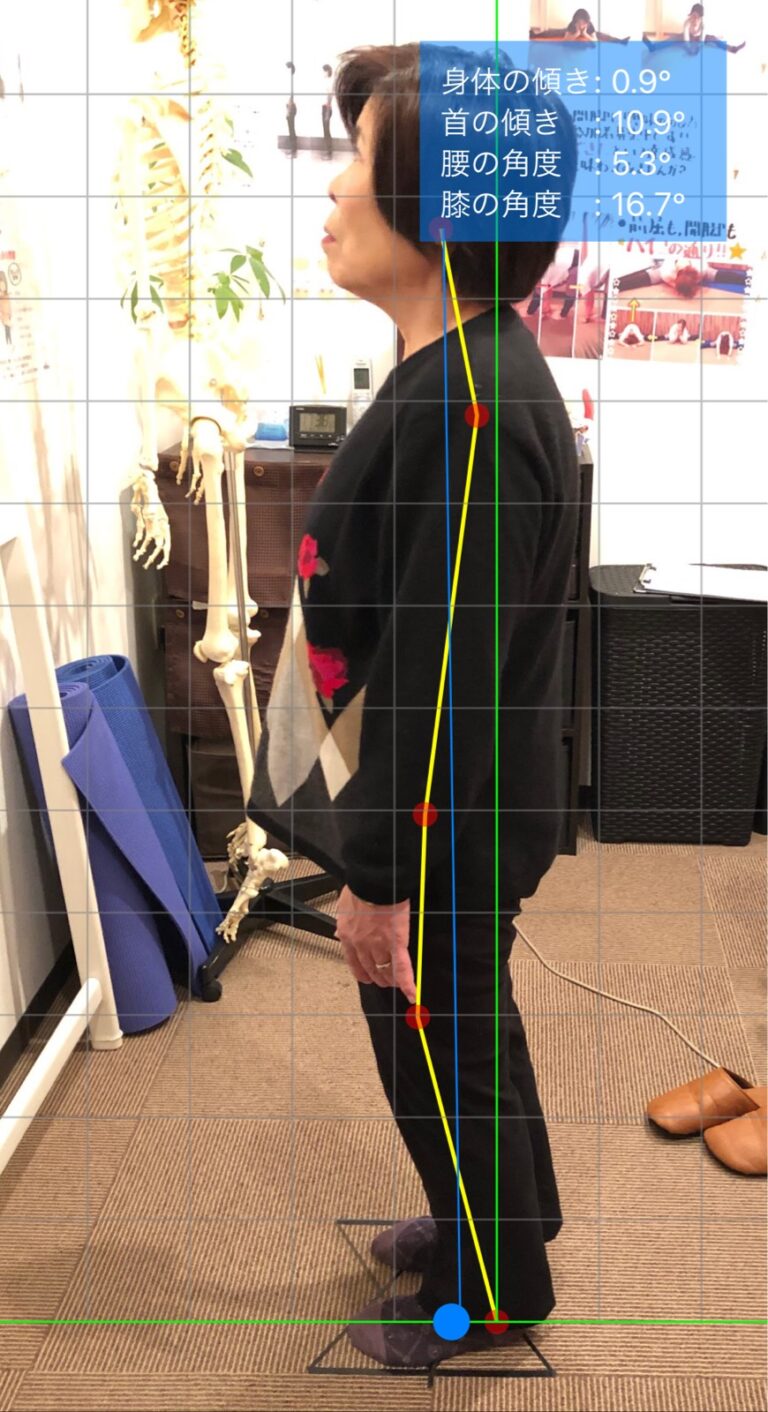 反り腰・姿勢の悩み