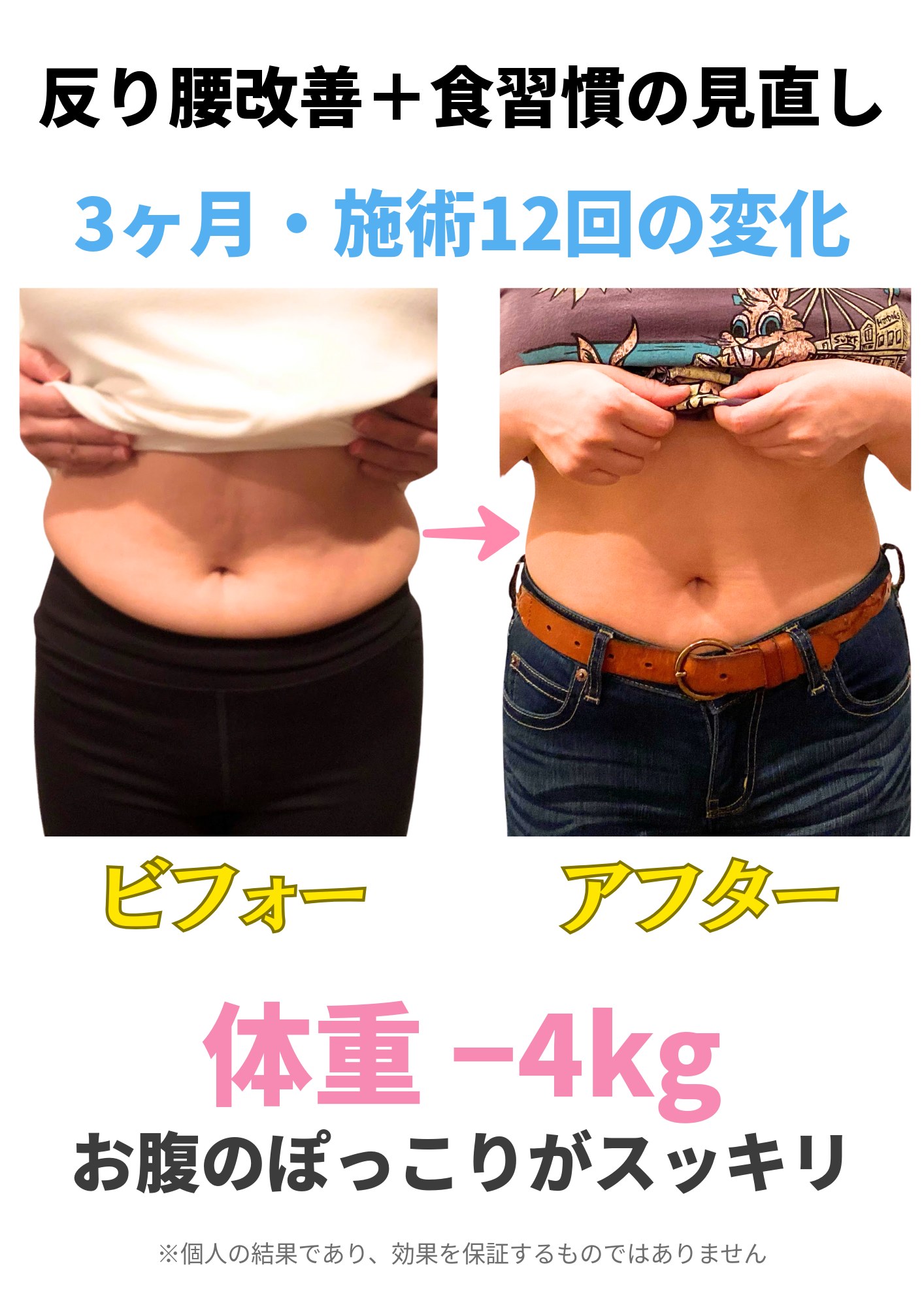 反り腰の改善と食習慣の見直しを3ヶ月続けた方の、お腹まわりの比較写真